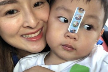 33岁前港姐大仔遭意外破相心痛不已狂飙泪曾被爆前后整容四次