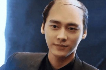 ​为什么很多秃顶的人就算周围只留一圈头发也不愿意剃成光头呢