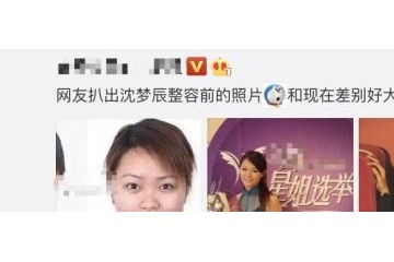 沈梦辰旧照曝光与现在不同大网友戏弄这是换头了